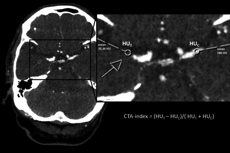 Fig. 1