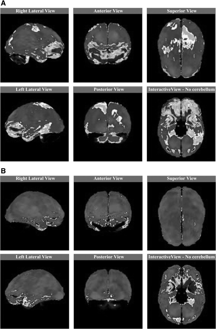 FIG. 3.