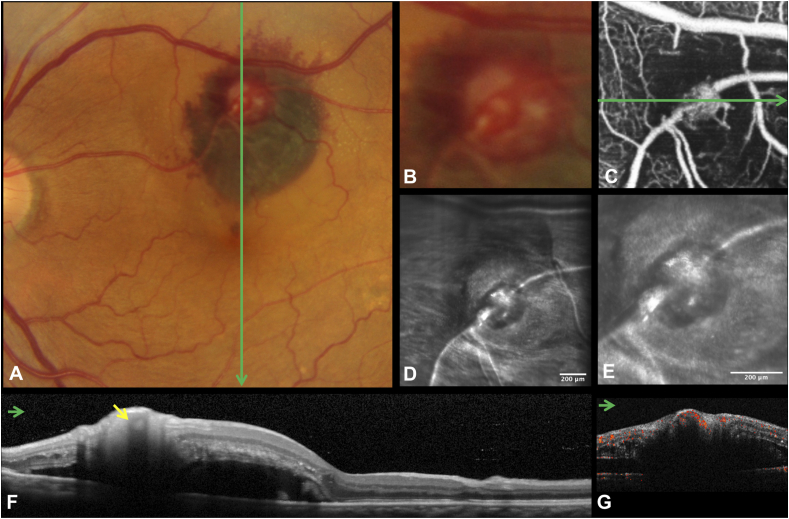 Fig. 1