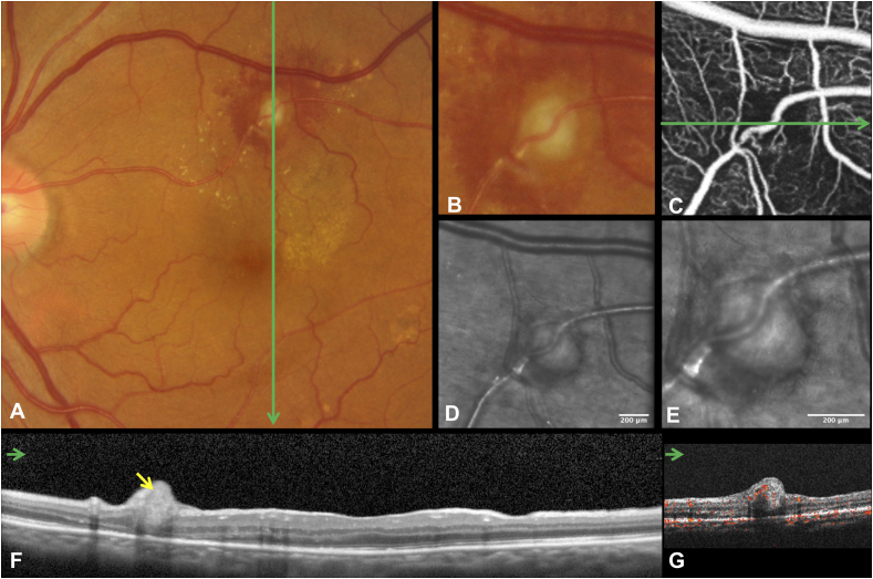 Fig. 2