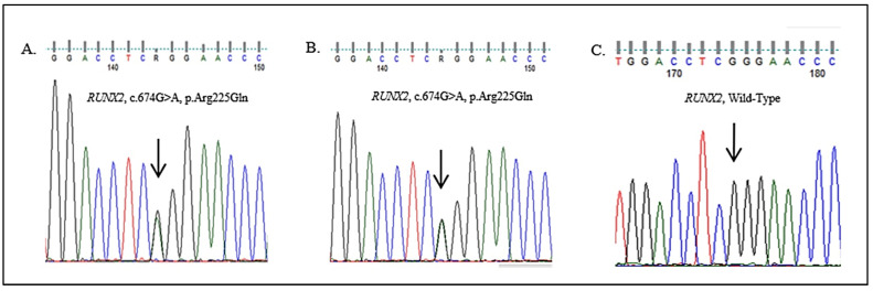 Figure 18