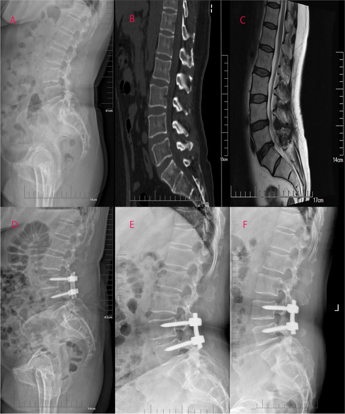 Fig. 4