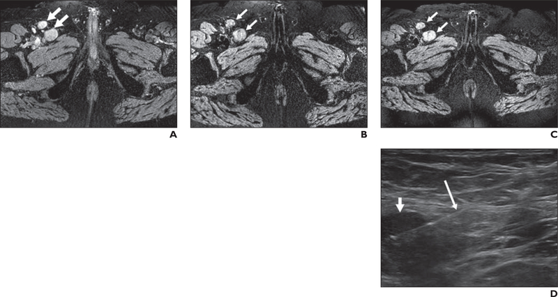 Fig. 1—