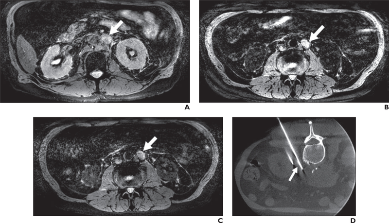 Fig. 2—