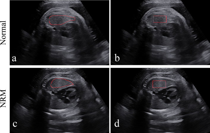 Fig. 5