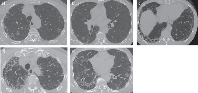 FIGURE 4