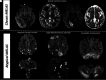 FIG 4.