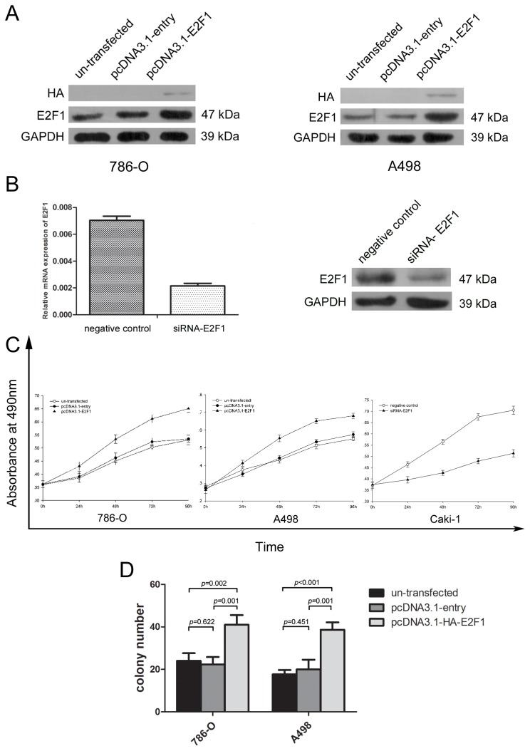 Overexpression of E2F1 Promotes Tumor Malignancy And Correlates with ...