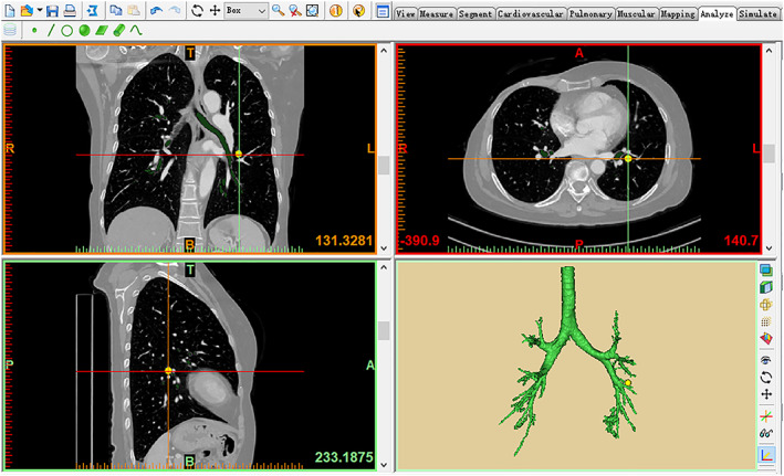 FIGURE 2