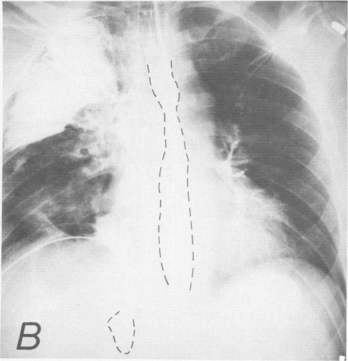 Fig. 2B.