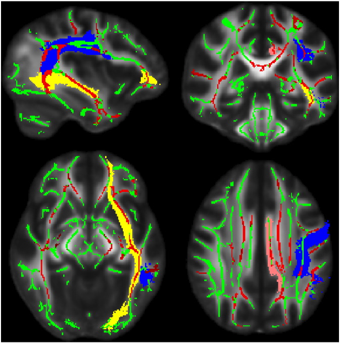 Fig. 1