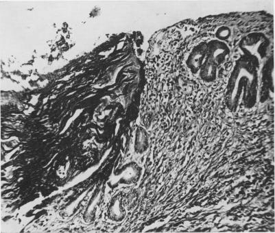 Fig. 1B.