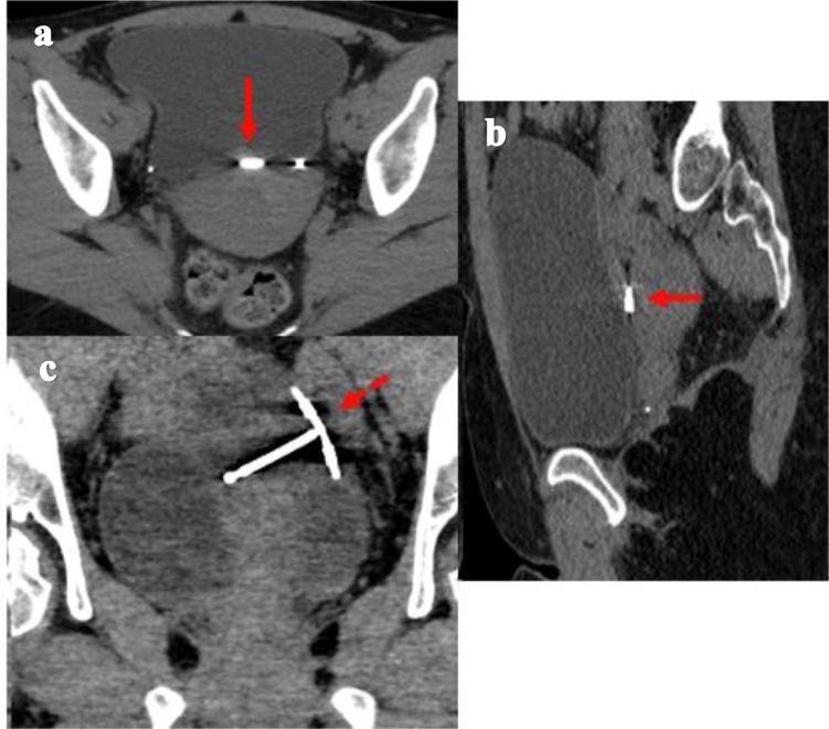 Fig 3