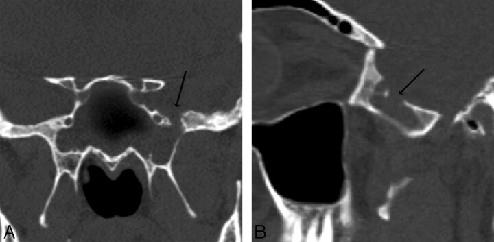 Fig 1.