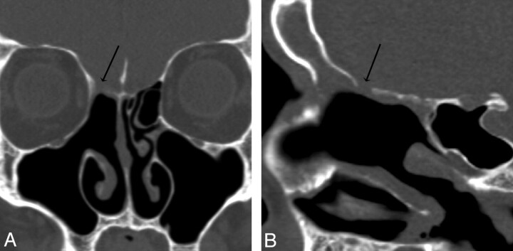 Fig 5.