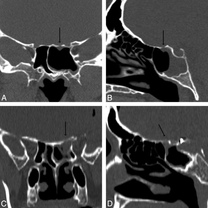 Fig 6.