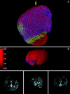 Fig 3.