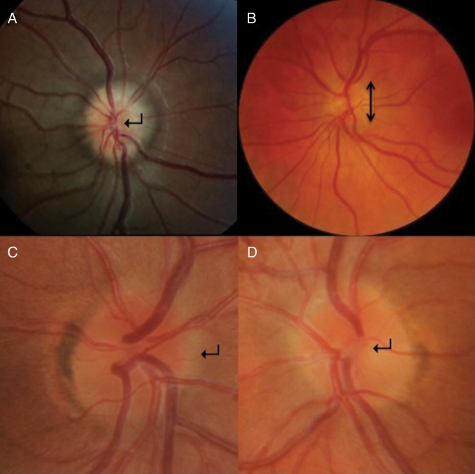 Figure 2