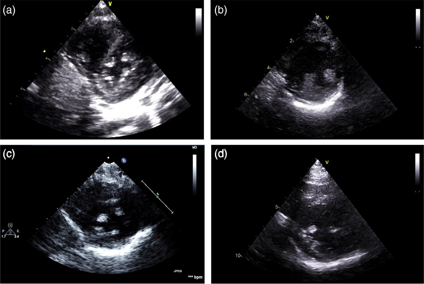 FIGURE 4