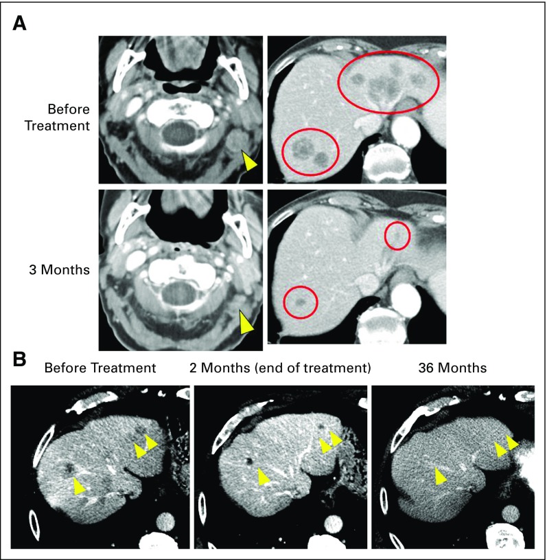 FIG 2.