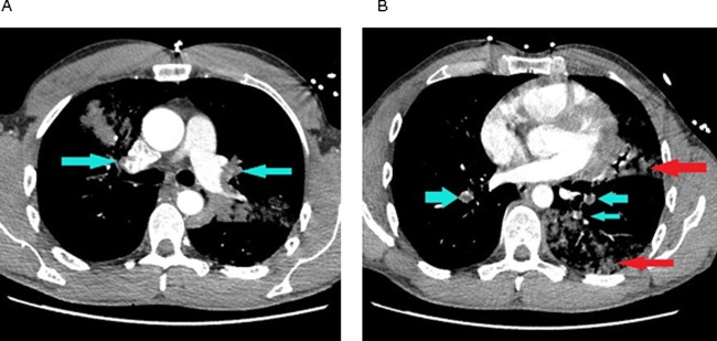 Figure 4