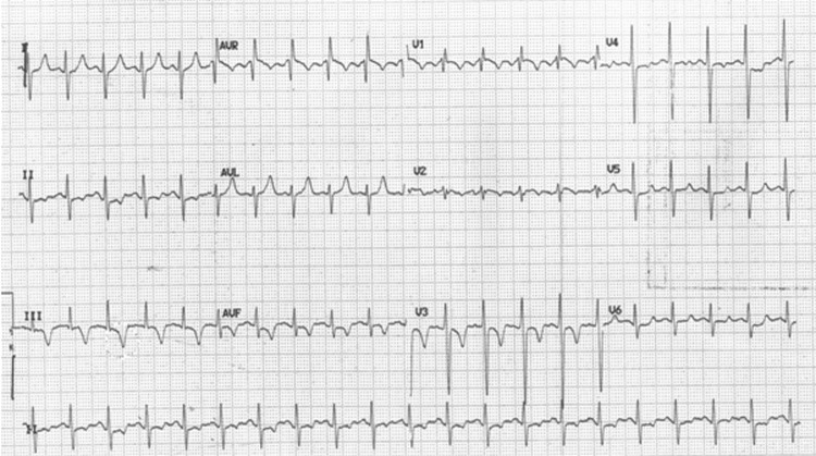 Figure 2