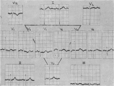 Fig. E