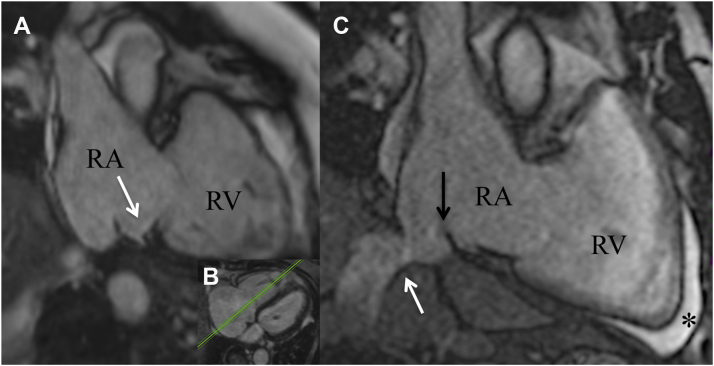 Figure 4