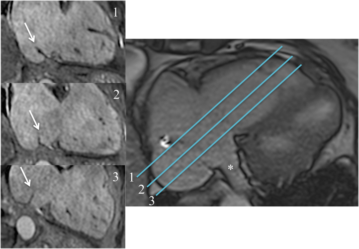 Figure 5