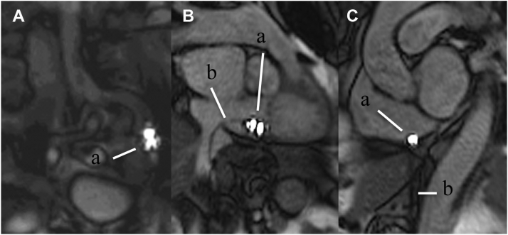 Figure 2