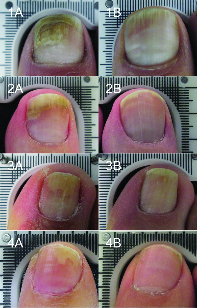 Figures 1–4.