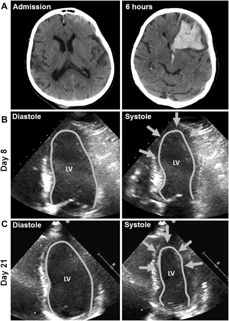 Fig. 1