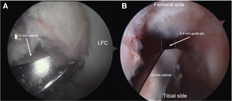 Fig 4