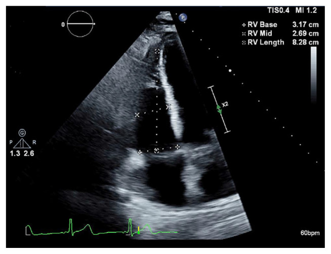 Fig. 2