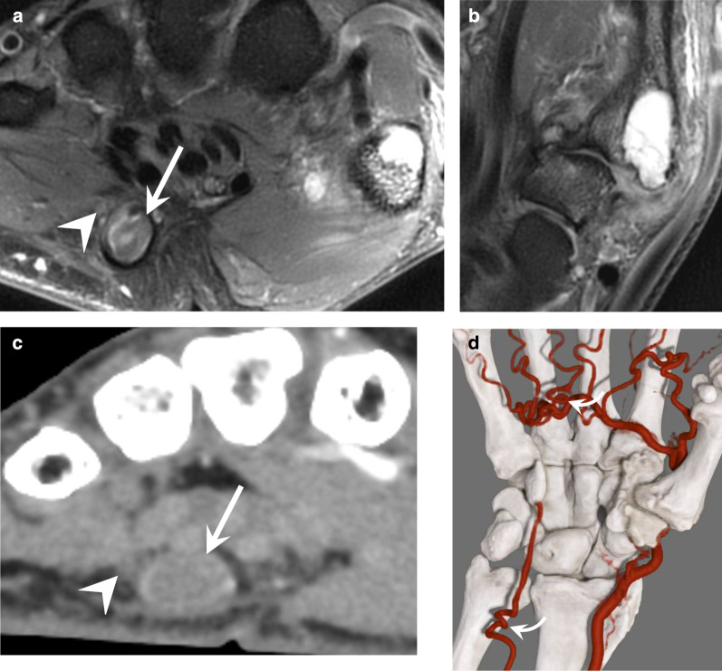 Fig. 10