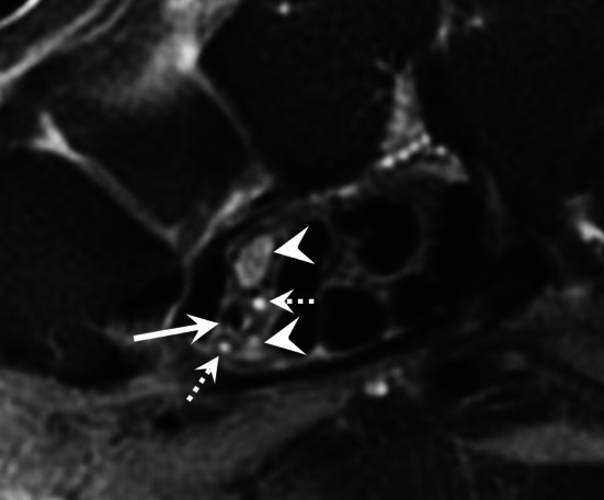 Fig. 13