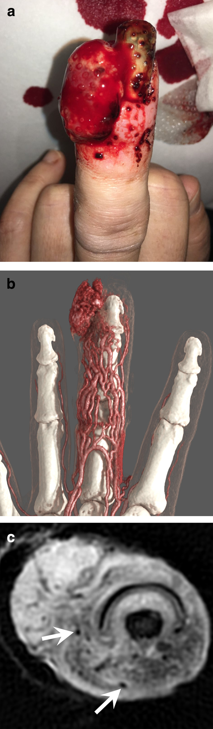 Fig. 15