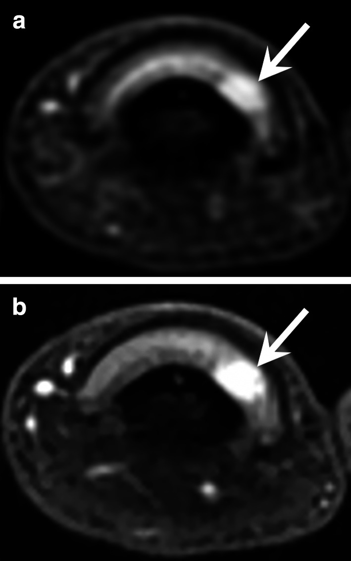 Fig. 22