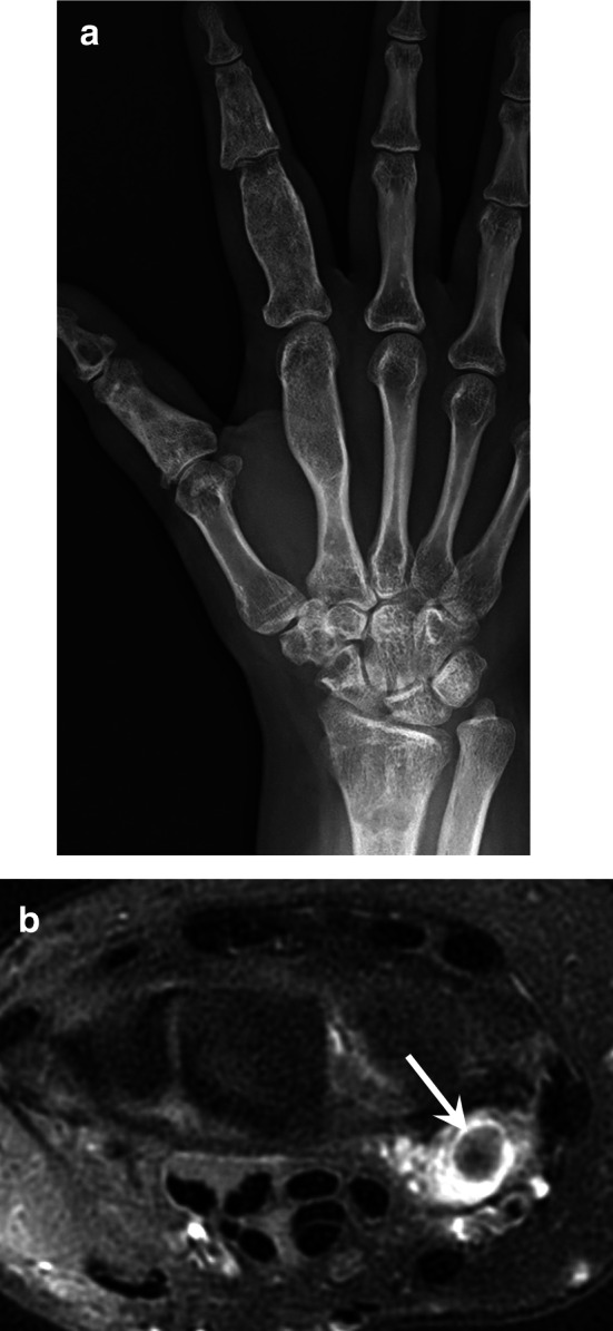 Fig. 17