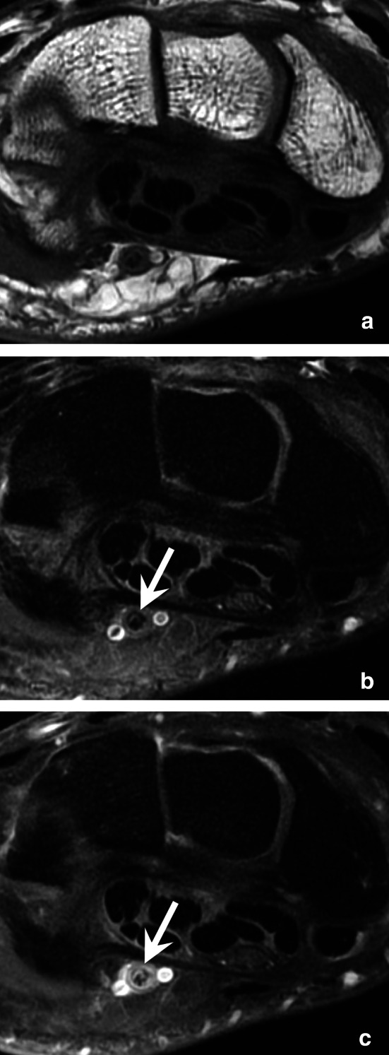 Fig. 11