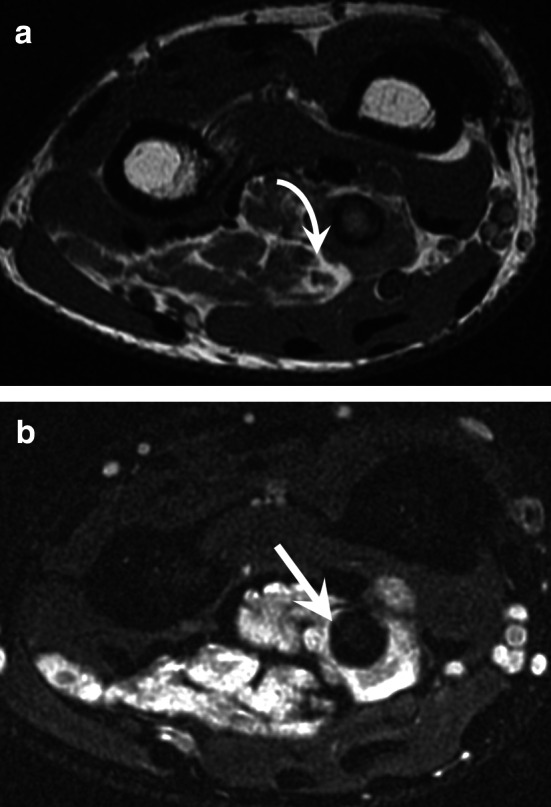 Fig. 16