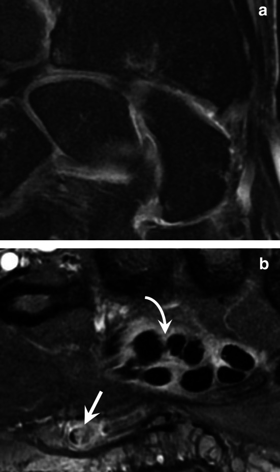 Fig. 12