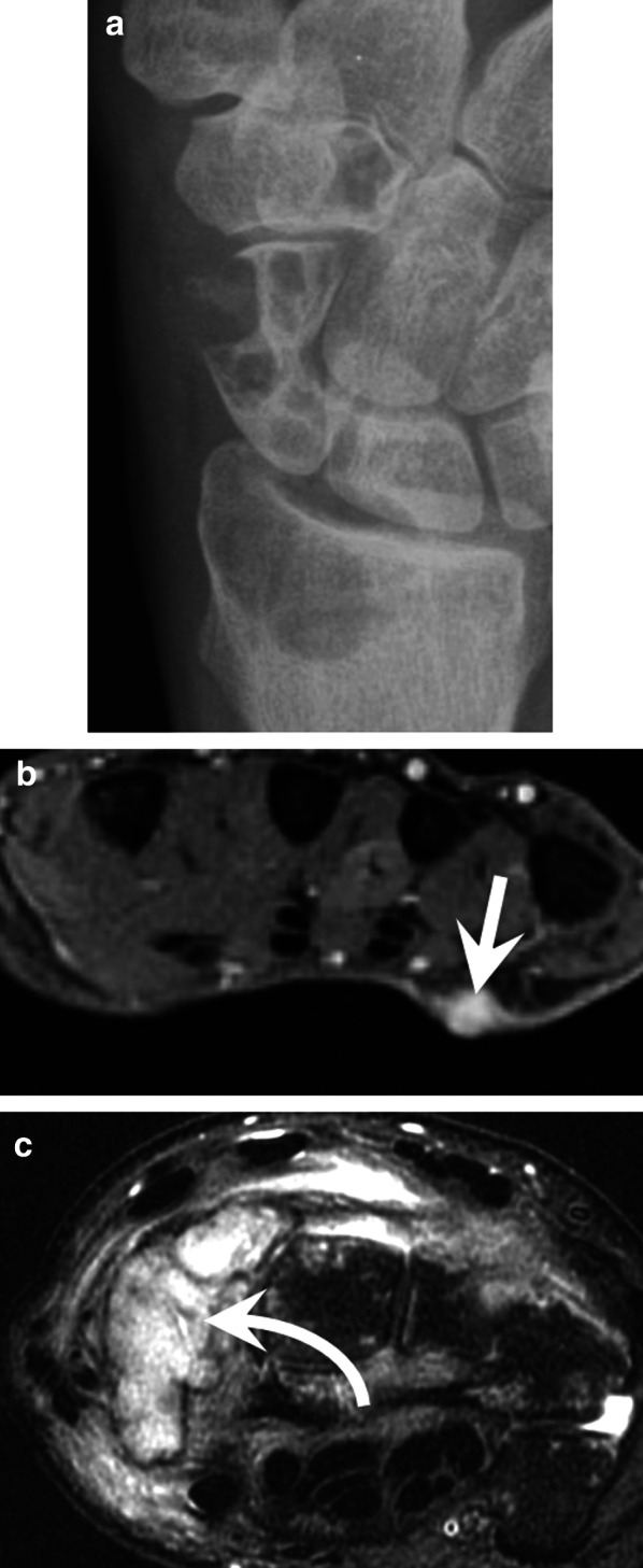 Fig. 20