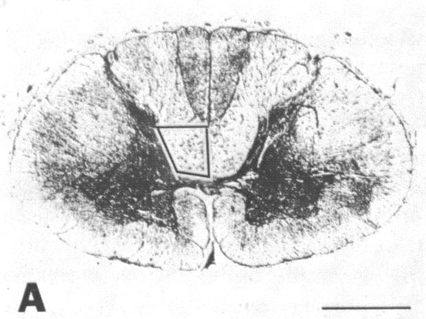 graphic file with name pnas00650-0275-i.jpg