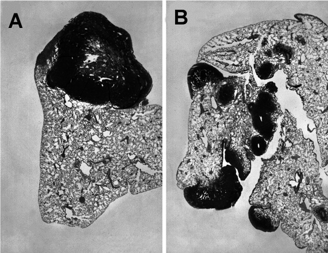 Fig. 5A,B