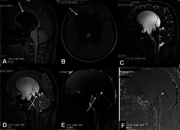 Fig. 10