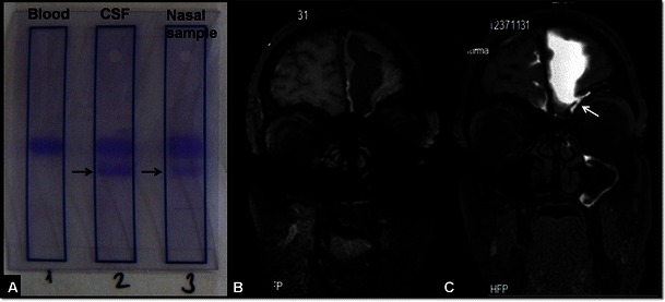 Fig. 11