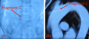 Figure 2: