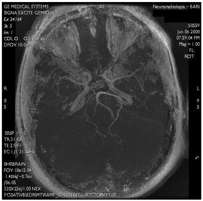 Fig 5