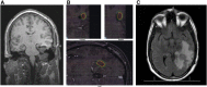 Fig. 3